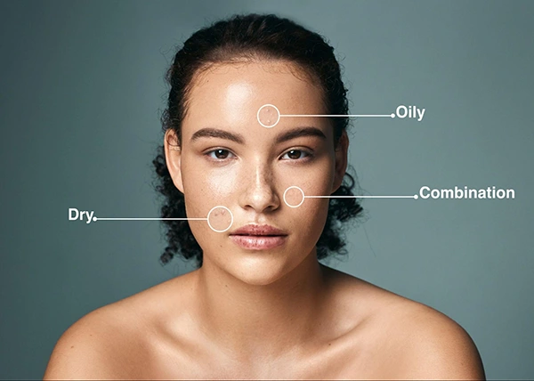 Different types of skin